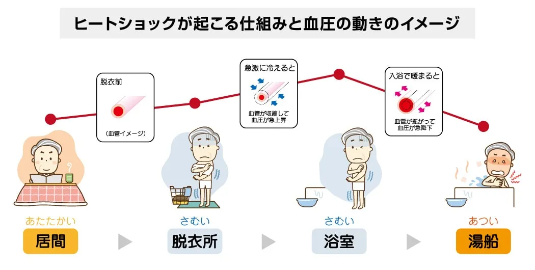 ヒートショックのメカニズム